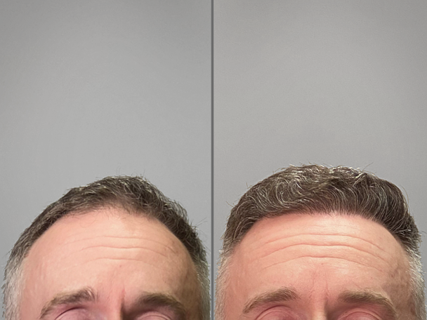 Patient Transformation