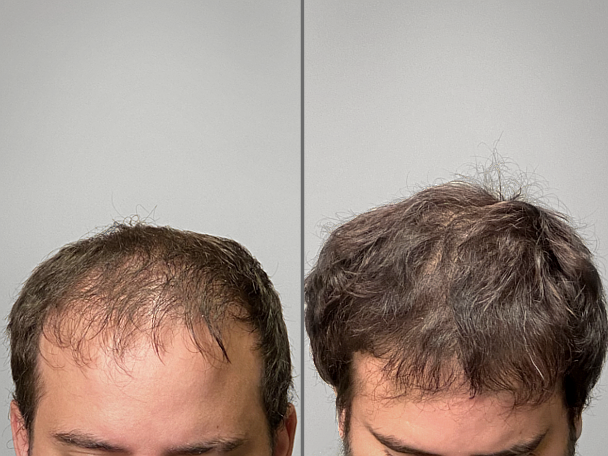 Patient Transformation