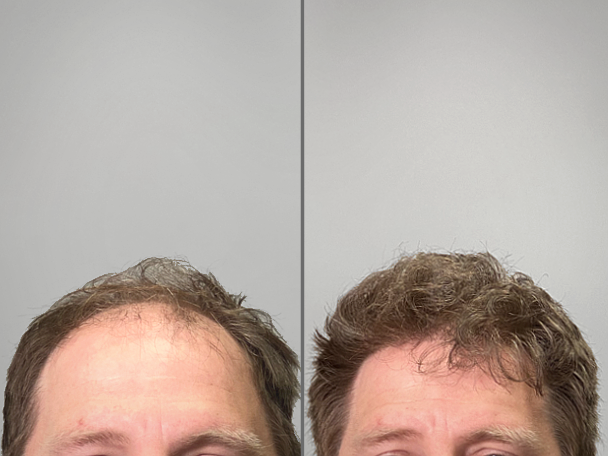 Patient Transformation