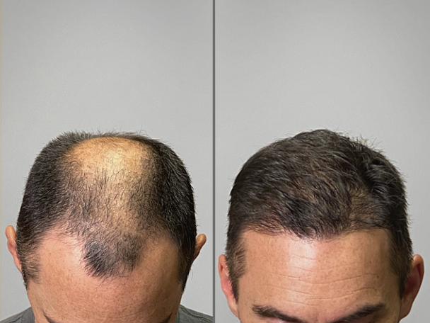 Patient Transformation