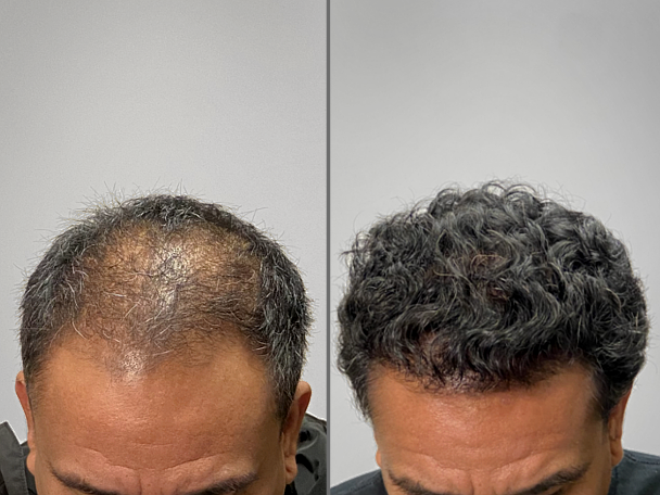 Patient Transformation