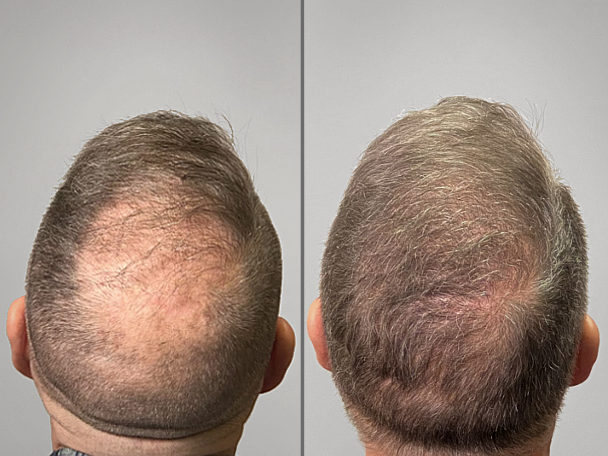 Patient Transformation