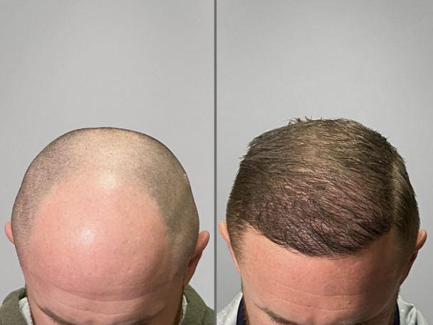 Patient Transformation